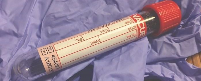 Флеботомия (гемоэксфузия)