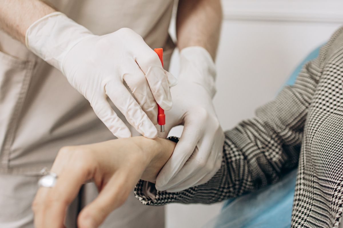 Меланома кожи